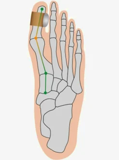 Coussinet pour hallux confortable à porter